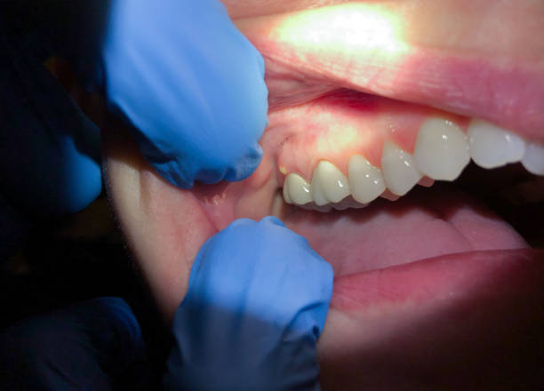 Best Emergency TMJ Treatment in South Glens Falls, NY